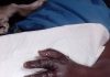 Mother recalls tragic child limb amputation